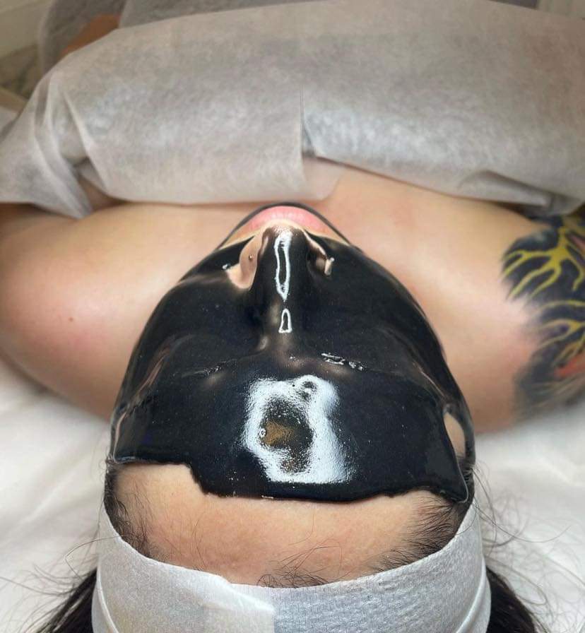 Person undergoing a black facial mask treatment at a spa.